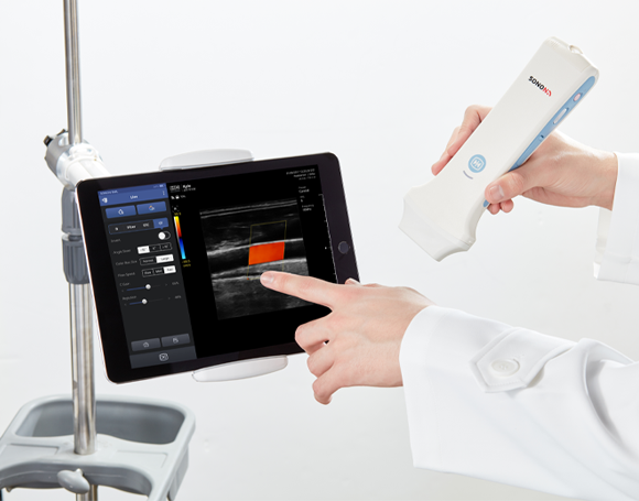 Портативный ультразвуковой сканер SONON 300L Healcerion Co., Ltd (Ю.Корея) -  поддерживает протоколы медицинской визуализации DICOM и PACS