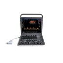 Ультразвуковой сканер SonoScape S8Exp