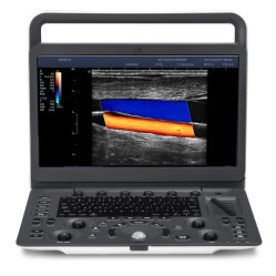 SonoScape E1 — портативный ультразвуковой сканер высокого класса