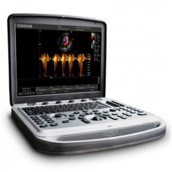 Портативная ультразвуковая диагностическая система «CHISON Sonotouch»  с принадлежностями, вариант исполнения SONOTOUCH 80, Китай