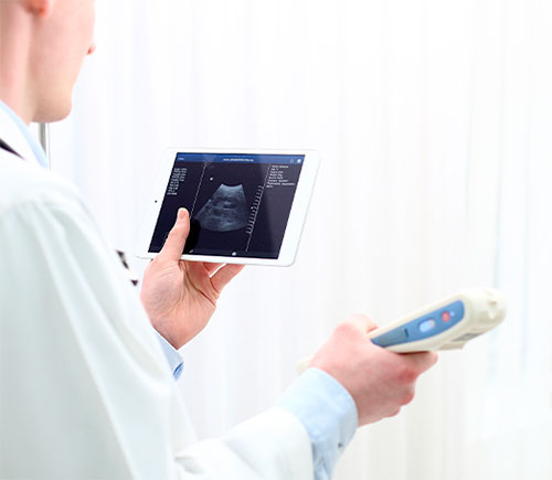 Купить портативный ультразвуковой сканер SONON 300C 