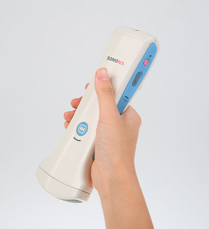 Портативный ультразвуковой сканер SONON 300C от компании Healcerion Co., Ltd (Ю.Корея) - Инновационное диагностическое устройство визуализации