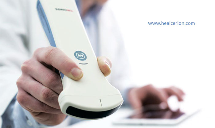 Портативный ультразвуковой сканер SONON 300С Healcerion Co., Ltd (Ю.Корея) -  поддерживает протоколы медицинской визуализации DICOM и PACS