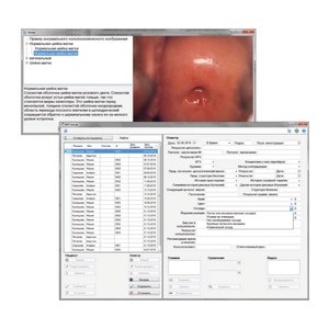Бинокулярный кольпоскоп с видеосистемой ALScope, Biomedicinos Techknika, Литва