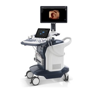 Ультразвуковая система SonoScape S60 — новый уровень диагностики с искусственным интеллектом