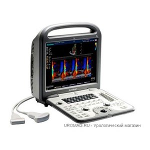 SonoScape S6 Pro портативная цветная цифровая ультразвуковая диагностическая система